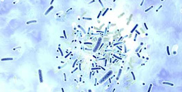 Sterilizzatori UV